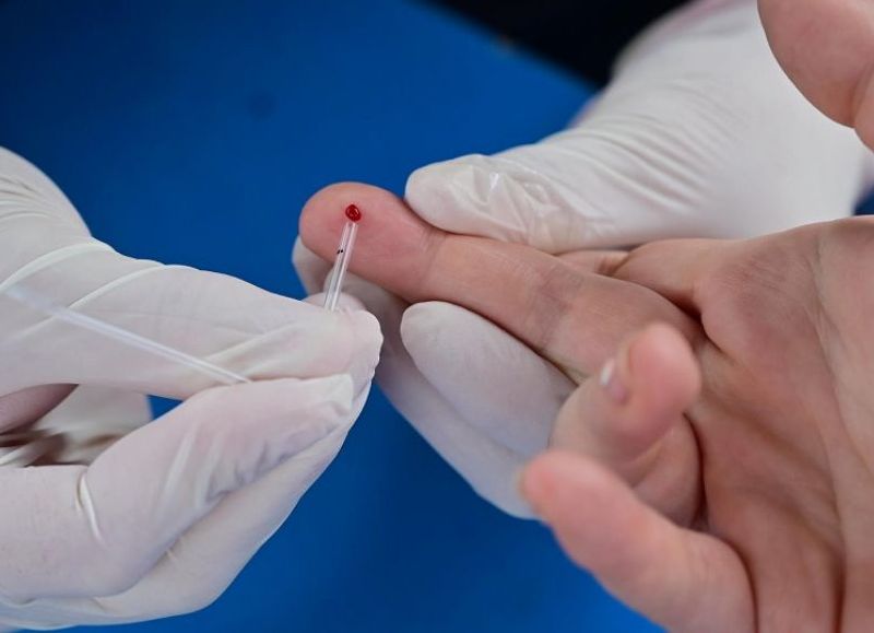 Jornada de testeo de HIV y sífilis